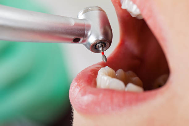 Best Emergency Dentist for Knocked-Out Tooth in Garretson, SD